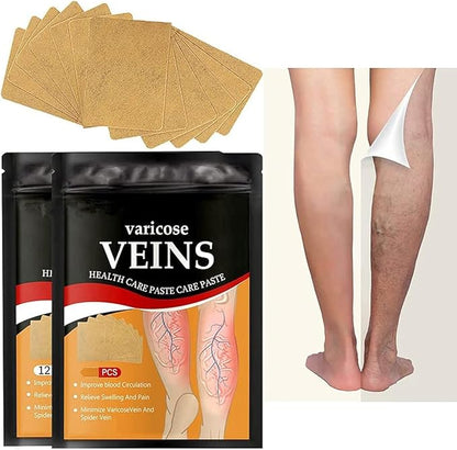 Varicose Vein Patches | Herbal Therapy for Swelling, Fatigue | 12 PCS